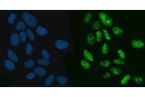 IF analysis of Exportin-5/XPO5 using anti-Exportin-5/XPO5 antibody (ABIN7598950).