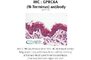 Image no. 2 for anti-G Protein-Coupled Receptor, Family C, Group 6, Member A (GPRC6A) (Extracellular Domain), (N-Term) antibody (ABIN1735226) (GPRC6A 抗体  (Extracellular Domain, N-Term))