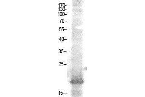 Western Blot (WB) analysis of AD-293 cells using Acetyl-NF-E4 (K43) Polyclonal Antibody. (NFE4 抗体  (acLys43))