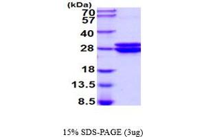 GLO1 Protein (AA 1-184) (His tag)