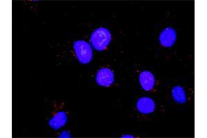Proximity Ligation Analysis of protein-protein interactions between CDK2 and PCNA. (PCNA 抗体  (AA 78-177))