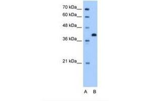 Image no. 1 for anti-Torsin Family 2, Member A (TOR2A) (AA 51-100) antibody (ABIN341411) (TOR2A 抗体  (AA 51-100))
