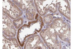 ABIN6272960 at 1/100 staining Mouse kidney tissue by IHC-P. (GLUD1 抗体  (Internal Region))