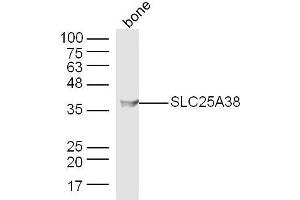 Mouse bone lysates probed with SLC25A38 Polyclonal Antibody, Unconjugated  at 1:300 dilution and 4˚C overnight incubation. (SLC25A38 抗体  (AA 101-200))