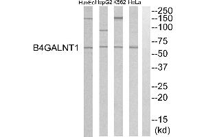 Western blot analysis of extracts from HeLa cells, K562 cells, HepG2 cells and HuvEC cells, using B4GALNT1 antibody. (B4GALNT1 抗体)