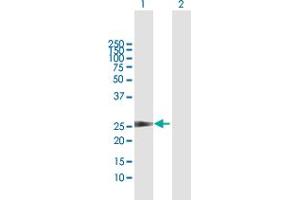 Western Blot analysis of CCBE1 expression in transfected 293T cell line by CCBE1 MaxPab polyclonal antibody. (CCBE1 抗体  (AA 1-215))