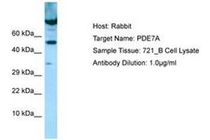 Image no. 1 for anti-phosphodiesterase 7A (PDE7A) (AA 338-387) antibody (ABIN6749987) (PDE7A 抗体  (AA 338-387))