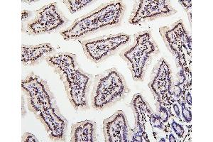 IHC analysis of H1F0 using anti-H1F0 antibody (ABIN7600521).