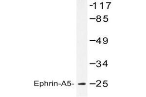 Western blot analysis of Ephrin-A5 antibody in extracts from HeLa cells. (Ephrin A5 抗体)
