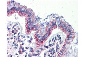 IMPDH1 antibody was used for immunohistochemistry at a concentration of 4-8 ug/ml.