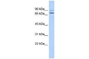 C9ORF75 antibody used at 1 ug/ml to detect target protein. (TPRN 抗体  (Middle Region))