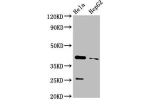 Western Blot Positive WB detected in: Hela whole cell lysate, HepG2 whole cell lysate All lanes: CD72 antibody at 3. (CD72 抗体  (AA 150-208))