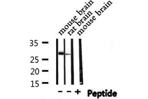 Western blot analysis of THOC4 expression in various lysates (THO Complex 4 抗体  (Internal Region))