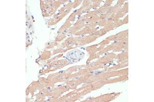 Immunohistochemistry (IHC) image for anti-Wingless-Type MMTV Integration Site Family, Member 5B (WNT5B) (AA 120-359) antibody (ABIN6150250)
