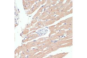 Immunohistochemistry of paraffin-embedded mouse kidney using WNT5B antibody (ABIN6130798, ABIN6150250, ABIN6150251 and ABIN6224330) at dilution of 1:100 (40x lens). (WNT5B 抗体  (AA 120-359))