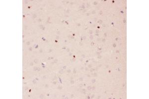 Anti-APE1 Picoband antibody,  IHC(P): Rat Brain Tissue (APEX1 抗体  (AA 2-318))