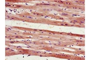 Immunohistochemistry of paraffin-embedded human heart tissue using ABIN7153133 at dilution of 1:100 (FHL2 抗体  (AA 112-233))