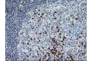 Image no. 4 for anti-Pyridoxal Kinase (PDXK) antibody (ABIN1500145)