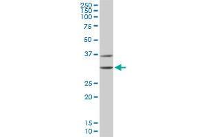 Western Blotting (WB) image for anti-Cyclin-Dependent Kinase 4 (CDK4) (AA 211-303) antibody (ABIN560292)