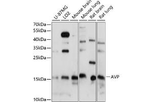 Western blot analysis of extracts of various cell lines, using AVP antibody (ABIN7265664) at 1:1000 dilution. (Vasopressin 抗体  (AA 20-164))