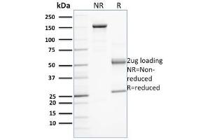 SDS-PAGE Analysis Purified PD-L1 Mouse Monoclonal Antibody (PDL1/2743). (PD-L1 抗体  (AA 39-191))