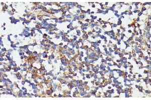 Immunohistochemistry of paraffin-embedded Human colon using CSF3 Polyclonal Antibody at dilution of 1:100 (40x lens). (G-CSF 抗体)