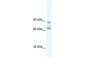 WB Suggested Anti-DDX42 Antibody Titration:  0. (DDX42 抗体  (N-Term))