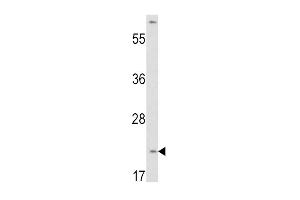 Western Blotting (WB) image for anti-Von Hippel-Lindau Tumor Suppressor, E3 Ubiquitin Protein Ligase (VHL) (AA 43-71), (N-Term) antibody (ABIN390462)