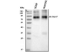 Western blot analysis of SLC6A17 using anti-SLC6A17 antibody (ABIN7599527).