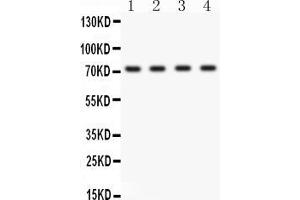 Western blot analysis of ABCG2 using anti-ABCG2 antibody .