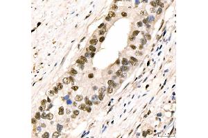 IHC analysis of CRTC3 using anti-CRTC3 antibody (ABIN7599779).