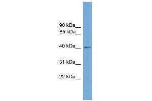 ZDHHC18 antibody used at 1 ug/ml to detect target protein. (ZDHHC18 抗体  (Middle Region))
