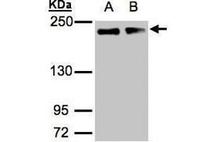 WB Image Sample(30 μg of whole cell lysate) A:A431, B:H1299 5% SDS PAGE antibody diluted at 1:1000 (Golgin A3 抗体  (C-Term))