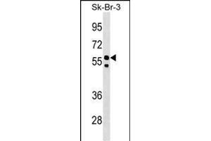 FBXO31 Antibody (Center) (ABIN1538289 and ABIN2848716) western blot analysis in SK-BR-3 cell line lysates (35 μg/lane). (FBXO31 抗体  (AA 310-338))