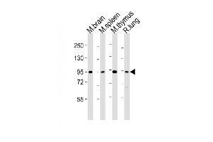All lanes : Anti-Med15 Antibody (C-term) at 1:2000 dilution Lane 1: mouse brain lysates Lane 2: mouse spleen lysates Lane 3: mouse thymus lysates Lane 4: rat lung lysates Lysates/proteins at 20 μg per lane. (MED15 抗体  (C-Term))