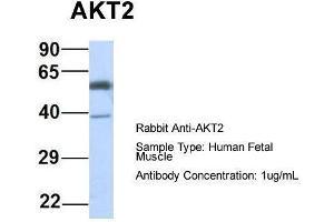 Host: Rabbit  Target Name: AKT2  Sample Tissue: Human Fetal Muscle  Antibody Dilution: 1. (AKT2 抗体  (Middle Region))