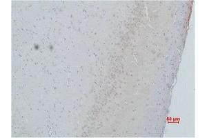 Immunohistochemistry (IHC) image for anti-Calcium Channel, Voltage-Dependent, gamma Subunit 2 (CACNG2) antibody (ABIN7189155)