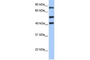 Human Jurkat; WB Suggested Anti-HCFC2 Antibody Titration: 0. (HCFC2 抗体  (C-Term))