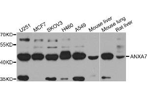 Western Blotting (WB) image for anti-Annexin A7 (ANXA7) (AA 237-466) antibody (ABIN1678673) (Annexin VII 抗体  (AA 237-466))