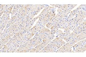 Detection of PPARg in Human Cardiac Muscle Tissue using Polyclonal Antibody to Peroxisome Proliferator Activated Receptor Gamma (PPARg) (PPARG 抗体  (AA 157-274))