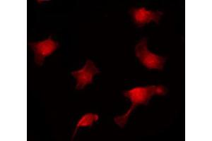 ABIN6267020 staining HuvEc by IF/ICC. (APC 抗体  (pSer2054))