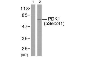 Western blot analysis of extracts from MDA-MB-435 cells using PDK1 (phospho-Ser241) antibody (E011005). (PDPK1 抗体  (pSer241))