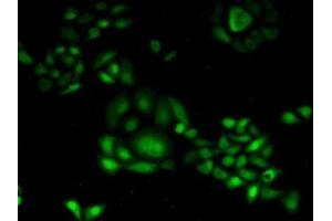 Detection of CDA in Human Hela Cells using Polyclonal Antibody to Cytidine Deaminase (CDA) (CDA 抗体  (AA 2-146))