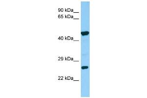 Host:  Rabbit  Target Name:  Sgcd  Sample Type:  Rat Small Intestine lysates  Antibody Dilution:  1. (SGCD 抗体  (Middle Region))