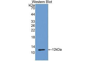 Western Blotting (WB) image for anti-Cadherin 1, Type 1, E-Cadherin (Epithelial) (CDH1) (AA 784-870) antibody (ABIN3209722) (E-cadherin 抗体  (AA 784-870))