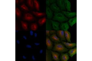 ABIN6265678 and ABIN6266689 staining  cells by IF/ICC. (TP53I11 抗体  (N-Term))