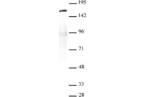 SMC1- α antibody (pAb) tested by Immunoprecipitation. (SMC1A 抗体  (C-Term))