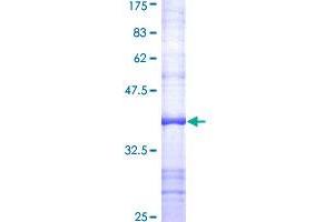 Image no. 1 for Fibroblast Activation Protein, alpha (FAP) (AA 525-624) protein (GST tag) (ABIN1353643)