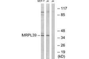 Western Blotting (WB) image for anti-Mitochondrial Ribosomal Protein L39 (MRPL39) (AA 289-338) antibody (ABIN2890417) (MRPL39 抗体  (AA 289-338))