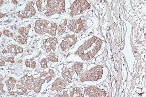 Immunohistochemistry of paraffin-embedded human stomach using MAP1LC3B antibody. (LC3B 抗体)